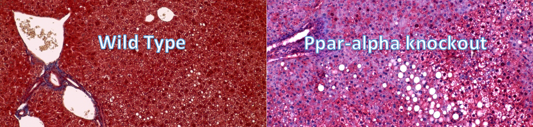 Trichrome stain of fibrosis in Ppara-KO mice